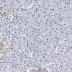 Immunohistochemical staining of human pancreas shows low expression as expected.