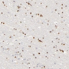 Anti-NKX2-2 Antibody