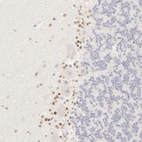 Immunohistochemical staining of human cerebellum shows moderate nuclear positivity in cells in molecular layer.