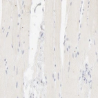 Immunohistochemical staining of human skeletal muscle shows no positivity in myocytes as expected.