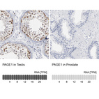 Anti-PAGE1 Antibody