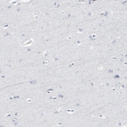 Immunohistochemical staining of human cerebral cortex shows no positivity in neurons as expected.