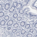 Immunohistochemical staining of human gastrointestinal shows no positivity in glandular cells as expected.