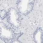 Anti-PAGE1 Antibody