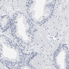 Immunohistochemical staining of human prostate shows no positivity in glandular cells as expected.