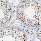 Anti-PAGE1 Antibody