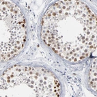 Immunohistochemical staining of human testis shows moderate nuclear positivity in cells in seminiferous ducts.