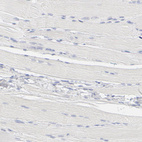 Immunohistochemical staining of human skeletal muscle shows no positivity in myocytes as expected.