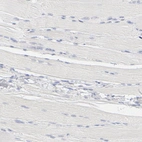 Immunohistochemical staining of human skeletal muscle shows no positivity in myocytes as expected.