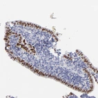 Immunohistochemical staining of human endometrium shows moderate to strong nuclear positivity in glandular cells.