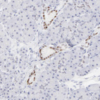 Anti-ELF3 Antibody