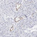 Immunohistochemical staining of human pancreas shows weak to moderate nuclear positivity in interlobular ducts.