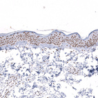 Anti-SNRPB Antibody