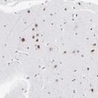 Immunohistochemical staining of human cerebral cortex shows moderate nuclear positivity in neurons.