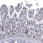 Anti-SNRPB Antibody