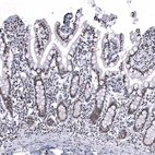 Immunohistochemical staining of human small intestine shows strong nuclear positivity in glandular cells.