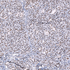 Anti-SNRPB Antibody