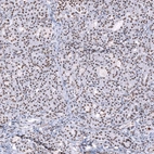 Immunohistochemical staining of human pancreas shows moderate nuclear positivity in exocrine glandular cells.