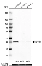 Western blot analysis in Caco-2 cells transfected with control siRNA, target specific siRNA probe #1 and #2, using Anti-SNRPB antibody. Remaining relative intensity is presented. Loading control: Anti-GAPDH.