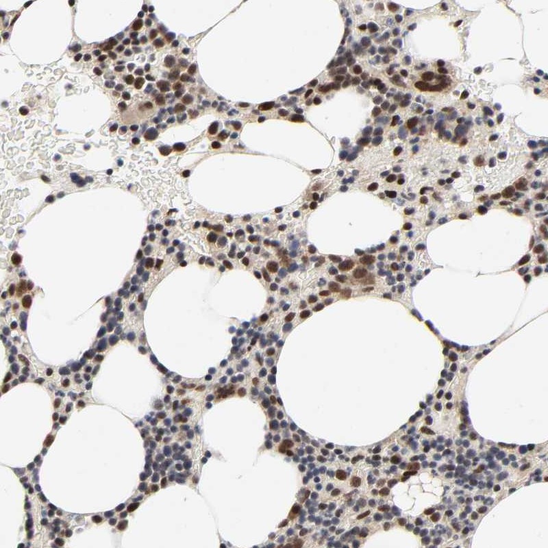 Anti-ZKSCAN8 Antibody