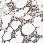 Anti-ZKSCAN8 Antibody