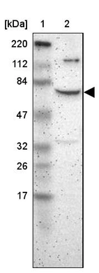 Lane 1: Marker [kDa] 220, 112, 84, 47, 32, 26, 17_br/_Lane 2: Human cell line RT-4