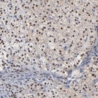 Anti-FOXN2 Antibody