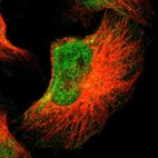 Immunofluorescent staining of human cell line U-251 MG shows localization to nucleoplasm.