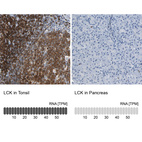 Anti-LCK Antibody