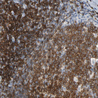 Immunohistochemical staining of human tonsil shows strong membranous/cytoplasmic membranous positivity in non-germinal center cells and germinal center cells.