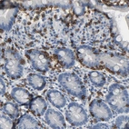Immunohistochemical staining of human duodenum shows strong membranous/cytoplasmic membranous positivity in lymphoid cells.