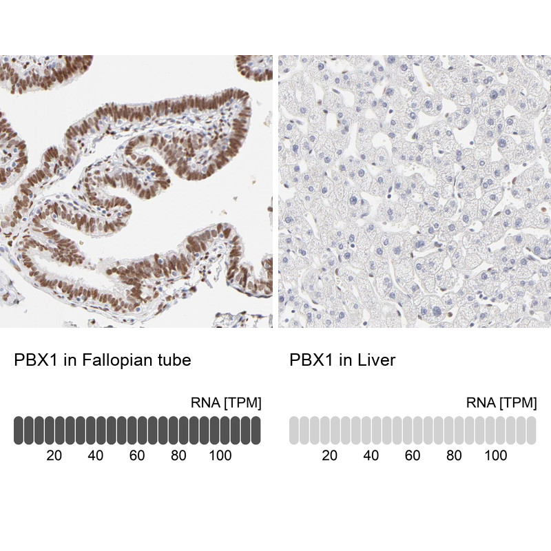 Anti-PBX1 Antibody