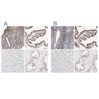 Immunohistochemical staining of human endometrium, fallopian tube, liver and prostate using Anti-PBX1 antibody HPA003505 (A) shows similar protein distribution across tissues to independent antibody HPA003881 (B).