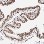 Immunohistochemical staining of human fallopian tube shows strong nuclear positivity in glandular cells.