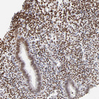Immunohistochemical staining of human endometrium shows moderate to strong nuclear positivity in stromal cells.