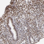 Immunohistochemical staining of human endometrium shows moderate to strong nuclear positivity in stromal cells.