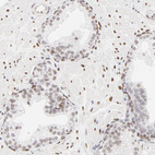 Anti-PBX1 Antibody