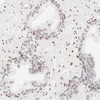 Immunohistochemical staining of human prostate shows weak to moderate nuclear positivity in glandular cells.