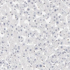 Immunohistochemical staining of human liver shows no positivity in hepatocytes as expected.