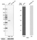 Western blot analysis in human cell lines HeLa and SK-MEL-30 using Anti-PBX1 antibody. Corresponding PBX1 RNA-seq data are presented for the same cell lines. Loading control: Anti-COX4I1.