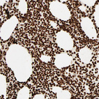 Anti-HMGB2 Antibody