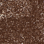 Anti-HMGB2 Antibody