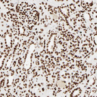 Anti-HMGB2 Antibody