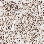 Immunohistochemical staining of human kidney shows strong nuclear positivity in cells in tubules.