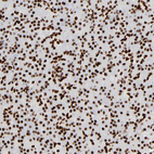 Anti-HMGB2 Antibody