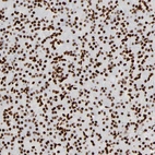 Immunohistochemical staining of human pancreas shows strong nuclear positivity in exocrine glandular cells.