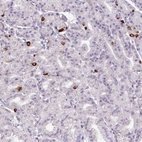 Anti-ASB1 Antibody