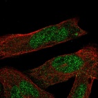 Immunofluorescent staining of human cell line RH-30 shows localization to nucleoplasm.