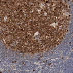 Immunohistochemical staining of human lymph node shows strong cytoplasmic positivity in germinal center cells.