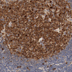 Anti-UBE2J1 Antibody